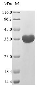 Recombinant Mouse fMet-Leu-Phe receptor(Fpr1),partial