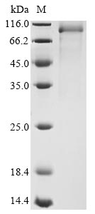 Recombinant Mouse kidney parvovirus Nonstructural protein NS1(rep)