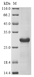 Recombinant Mumps virus Hemagglutinin-neuraminidase(HN),partial