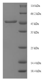 Recombinant Mycobacterium tuberculosis Diacylglycerol acyltransferase/mycolyltransferase Ag85B(fbpB)