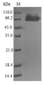 Recombinant Mycobacterium tuberculosis Putative amidase AmiB2(amiB2)
