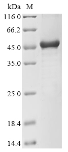 Recombinant Mycoplasma pneumoniae P30 adhesin(p30),partial