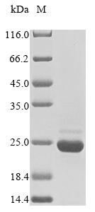 Recombinant Mycoplasma pneumoniae Protein P200(p200),partial