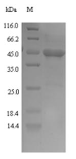 Recombinant Naja kaouthia Cobra venom factor,partial