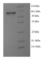Recombinant Peptoclostridium difficile NAD-specific glutamate dehydrogenase(gluD)