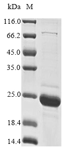 Recombinant Pig Alpha-synuclein(SNCA)