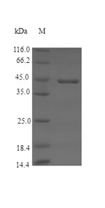 Recombinant Pig Coagulation factor XII(F12),partial