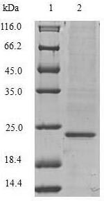 Recombinant Pig Vascular endothelial growth factor A(VEGFA)