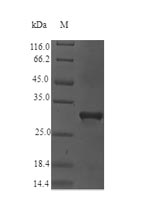 Recombinant Plantago lanceolata Major pollen allergen Pla l 1