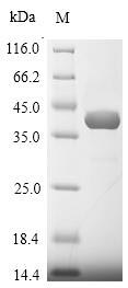 Recombinant Plasmodium berghei L-lactate dehydrogenase(PB000185.00.0)