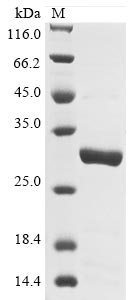Recombinant Pongo abelii Lysosome-associated membrane glycoprotein 5(LAMP5),partial