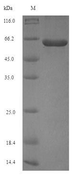 Recombinant Porphyromonas gingivalis Peptidylarginine deiminase(PG_1424)