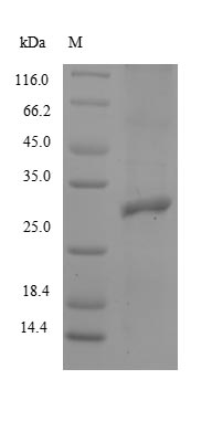 Recombinant Rabbit Integrin beta-8(ITGB8),partial