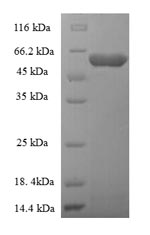 Recombinant Rabies virus Glycoprotein(G),partial