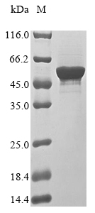 Recombinant Rabies virus Nucleoprotein(N)