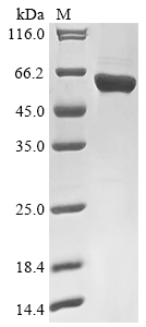 Recombinant Rabies virus Nucleoprotein(N)