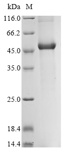 Recombinant Ralstonia pickettii Poly (3-hydroxybutyrate) depolymerase