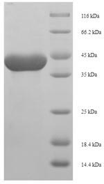 Recombinant Rat Anionic trypsin-1(Prss1)
