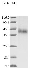 Recombinant Rat Asialoglycoprotein receptor 1(Asgr1),partial