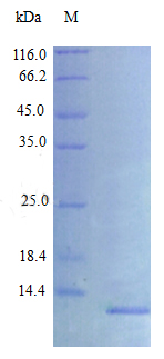 Recombinant Rat C-X-C motif chemokine 10 protein(Cxcl10) (Active)