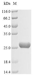 Recombinant Rat Carbamoyl-phosphate synthase [ammonia], mitochondrial(Cps1),partial