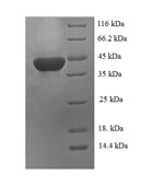 Recombinant Rat Carbonic anhydrase 1(Ca1)