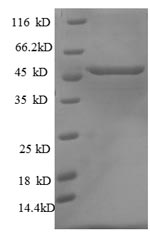 Recombinant Rat Cellular tumor antigen p53(Tp53)