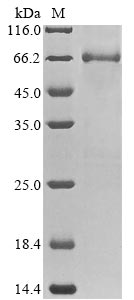 Recombinant Rat Electron transfer flavoprotein-ubiquinone oxidoreductase, mitochondrial(Etfdh)