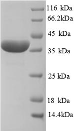 Recombinant Rat Haptoglobin(Hp),partial