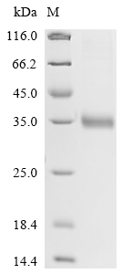 Recombinant Rat Mannose-binding protein C(Mbl2)