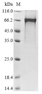 Recombinant Rat Netrin-1(Ntn1)