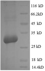 Recombinant Rat Osteocalcin(Bglap)