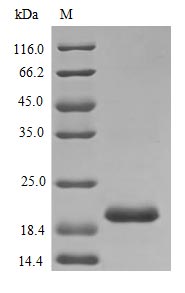 Recombinant Rat Prolactin protein(Prl) (Active)