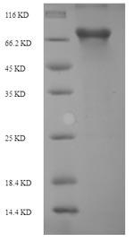 Recombinant Rat Putative phospholipase B-like 2(Plbd2)