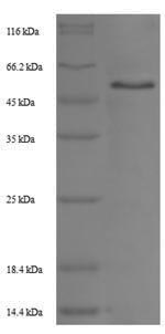 Recombinant Rat Trophoblast glycoprotein(Tpbg),partial