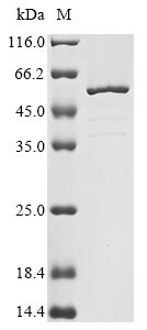 Recombinant Rat Troponin T, cardiac muscle(Tnnt2)