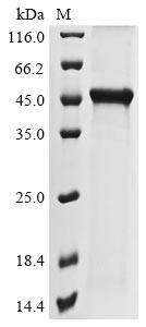Recombinant Rattus norvegicus polyomavirus 2 Major capsid protein VP1(RatPyV2_gp1)