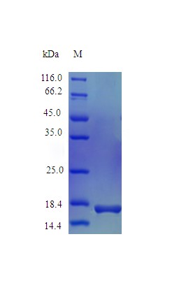 Recombinant Rhesus Macaque Interleukin-1 beta protein(IL1B) (Active)