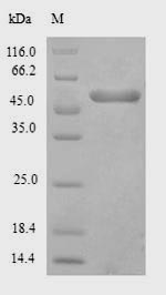 Recombinant Saccharomyces cerevisiae Exopolyphosphatase(PPX1)