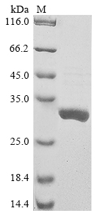 Recombinant Sandfly fever sicilian virus Nucleoprotein(N)