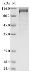 Recombinant Severe acute respiratory syndrome coronavirus 2 RNA-dependent RNA polymerase(NSP12)