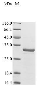 Recombinant Shigella sonnei AcrAB operon repressor(acrR)