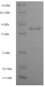 Recombinant Staphylococcus aureus Enterotoxin type D(entD) 