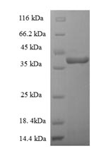 Recombinant Staphylococcus aureus Enterotoxin type G(entG)