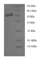 Recombinant Staphylococcus aureus Staphopain B(sspB)