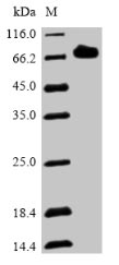 Recombinant Streptococcus pneumoniae serotype 2 Pneumolysin(ply)