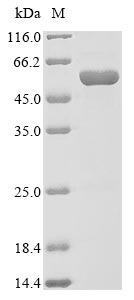 Recombinant Streptococcus pneumoniae serotype 4 Pneumolysin(ply)