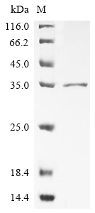 Recombinant Streptococcus pyogenes Immunoglubulin-degrading enzyme(ideS)