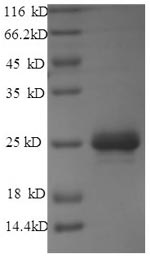 Recombinant Streptomyces hygroscopicus Phosphinothricin N-acetyltransferase(bar)