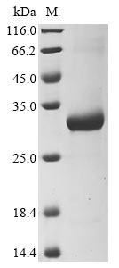 Recombinant Superoxide dismutase [Cu-Zn](sodC)